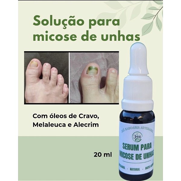 Sérum Anti Micose e Fortalecedor de Unhas