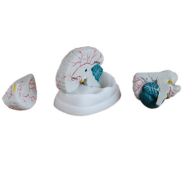 Modelo Dissecção do Cérebro Humano (3 peças) Pintado