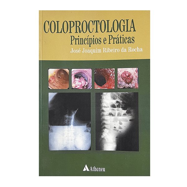 Coloproctologia - José Joaquim Ribeiro da Rocha