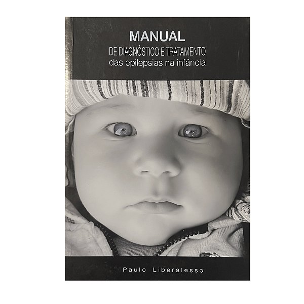 Manual De Diagnóstico E Tratamento Das Epilepsias Na Infância - Paulo Liberalesso
