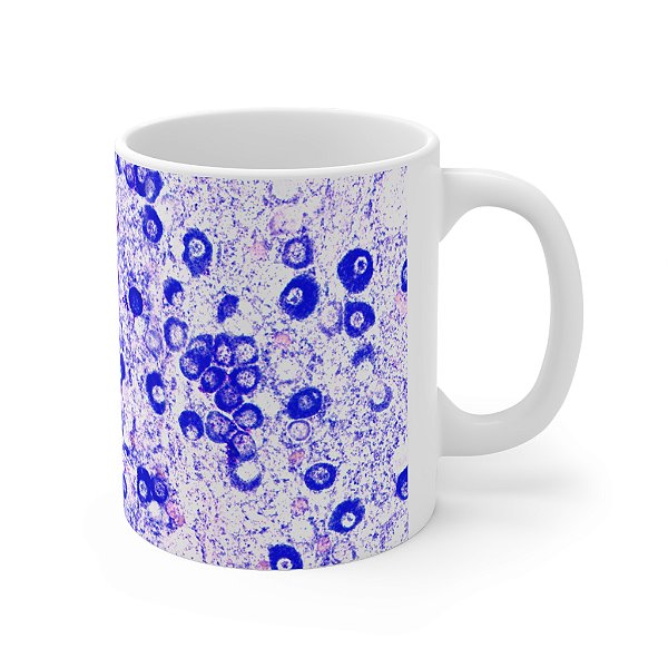 Caneca Mastocitoma Citologia