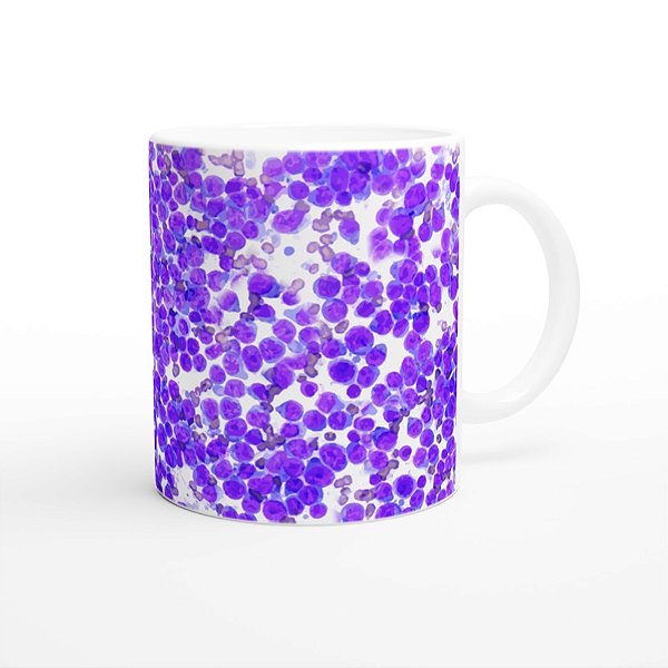 Caneca Citologia Linfoma – Para Amantes da Patologia Veterinária