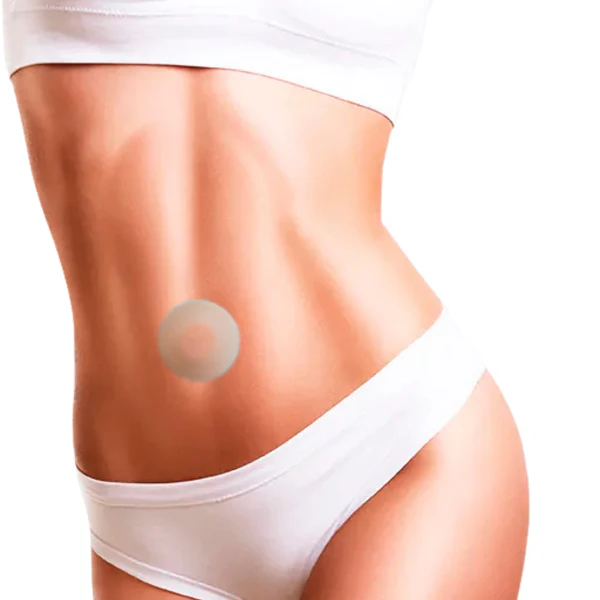 Fita de Silicone Pós Abdominoplastia - NullScar Órtese Umbilical