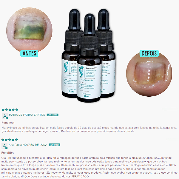 Fungifeet antimicótico fortalecedor e regenerador de unhas fracas com micose e fungo 100% natural 20mL podólogo Maurélio