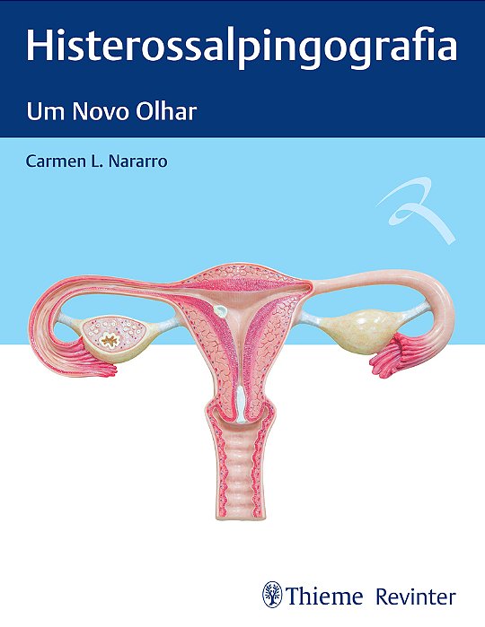 Histerossalpingografia Um Novo Olhar..-