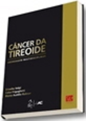 Câncer Da Tireoide - Abordagem Multidisciplinar