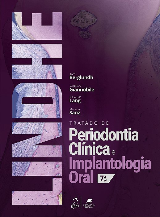 Tratado De Periodontia Clinica E Implantologia Oral