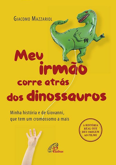 Meu Irmão Corre Atrás Dos Dinossauros Minha História E De Giovanni, Que Tem Um Cromossomo A Mais
