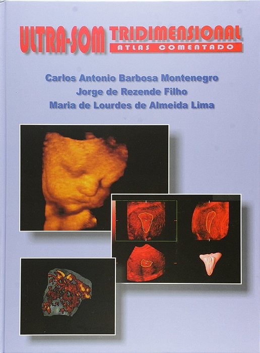 Ultra-Som Tridimensional - Atlas Comentado