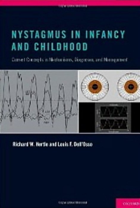 Nystagmus In Infancy And Childhood-..