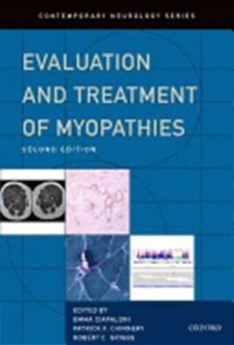 Evaluation And Treatment Of Myopathies - 2ND Edition-..