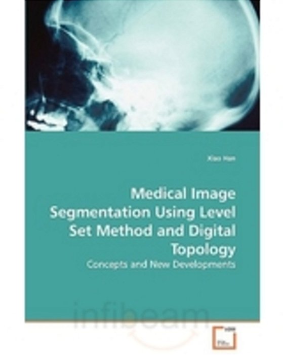 Medical Image Segmentation Using Level Set Method And Digital Topology-..