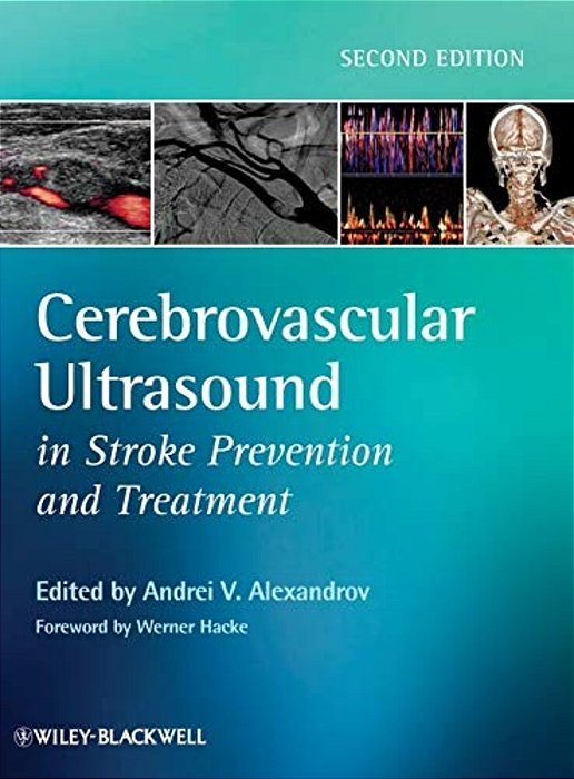Cerebrovascular Ultrasound In Stroke Preventionand Treatment-..