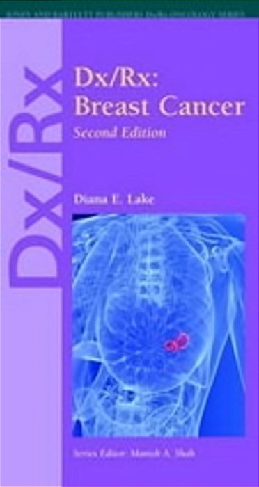 Dx/Rx: Breast Cancer - 2ND Edition-..