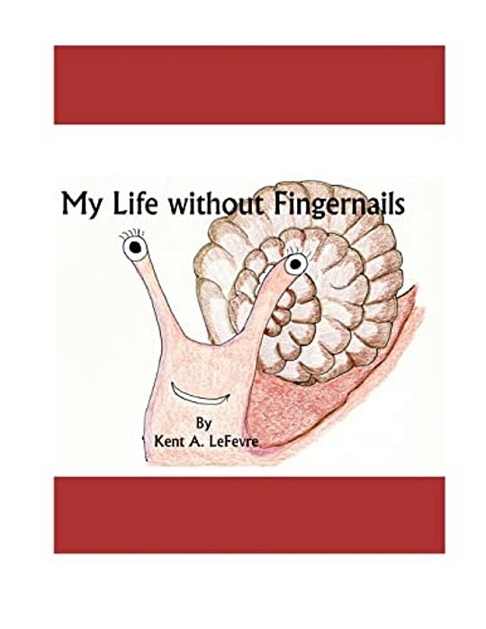 My Life Without Fingernails-..