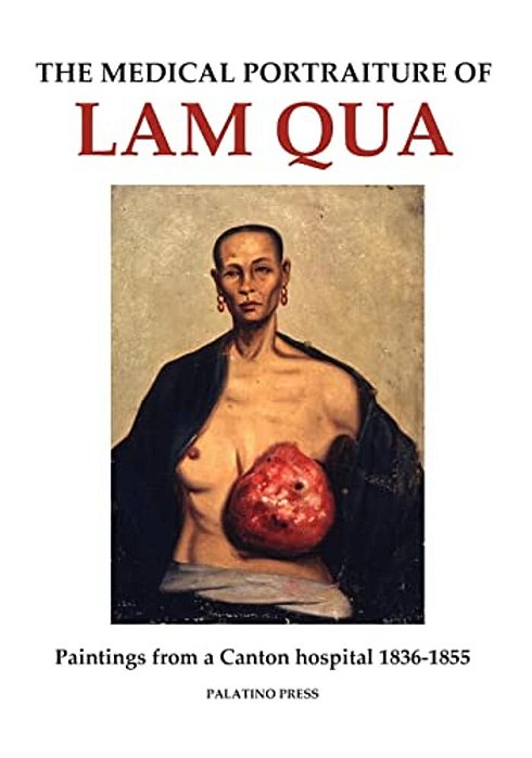 The Medical Portraiture Of Lam Qua: Paintings From A Canton Hospital 1836-1855-..