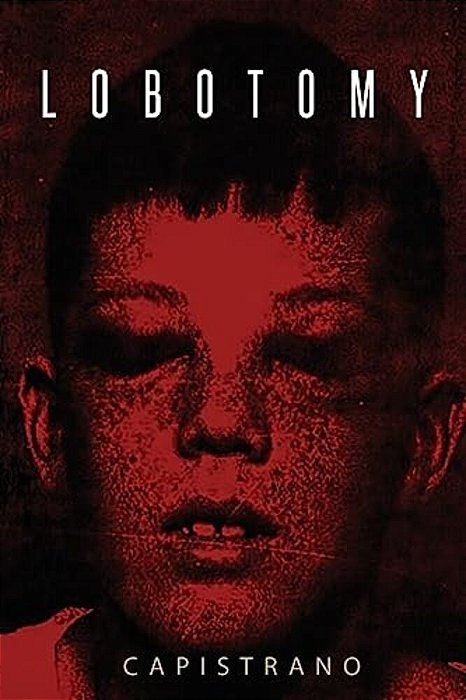 Lobotomy: Chemistry By Capi-..