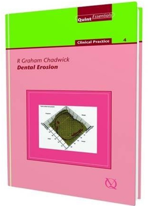 Dental Erosion-..