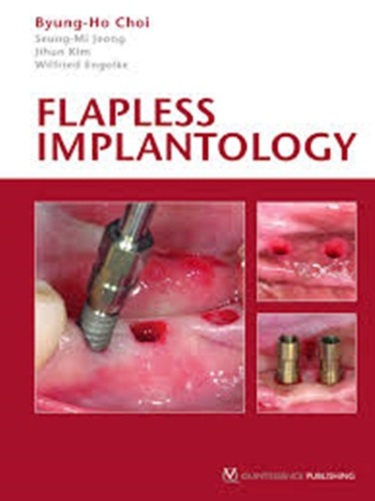 Flapless Implantology-..