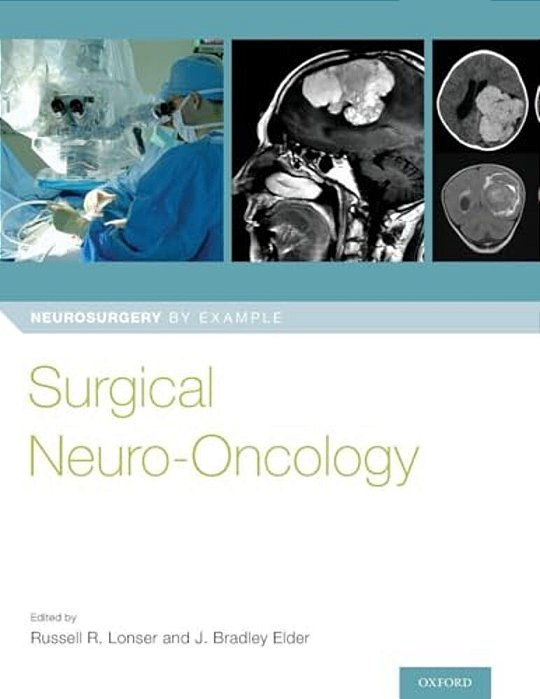 Surgical Neuro-Oncology-..