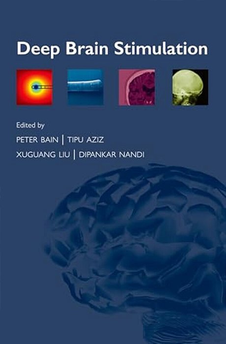 Deep Brain Stimulation-..