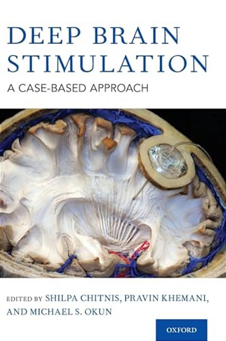 Deep Brain Stimulation: A Case-Based Approach-..
