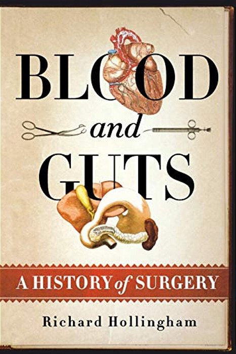 Blood And Guts: A History Of Surgery-..