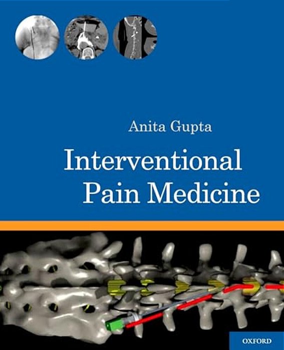 Interventional Pain Medicine-..