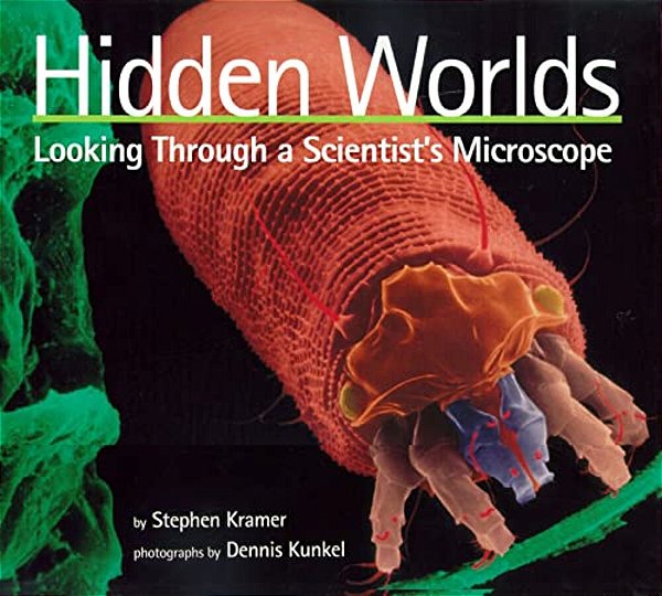 Hidden Worlds: Looking Through A Scientist's Microscope-..