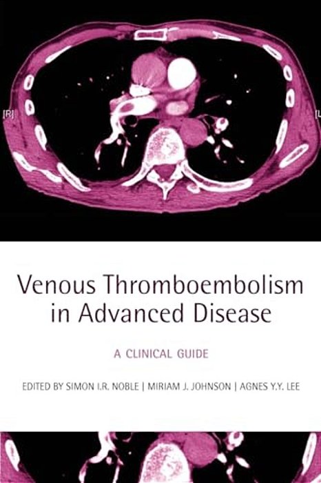 Venous Thromboembolism In Advanced Disease: A Clinical Guide-..