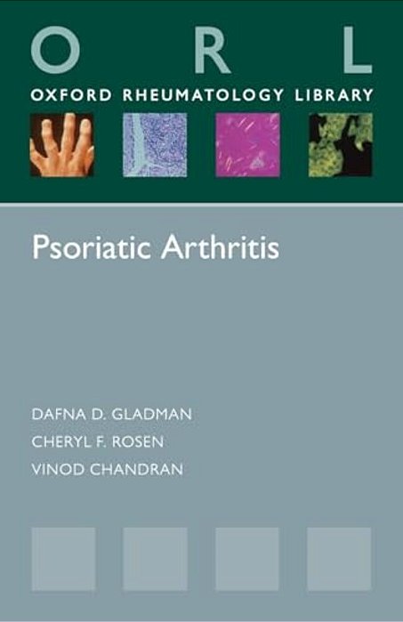 Psoriatic Arthritis-..