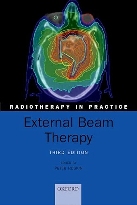 External Beam Therapy-..