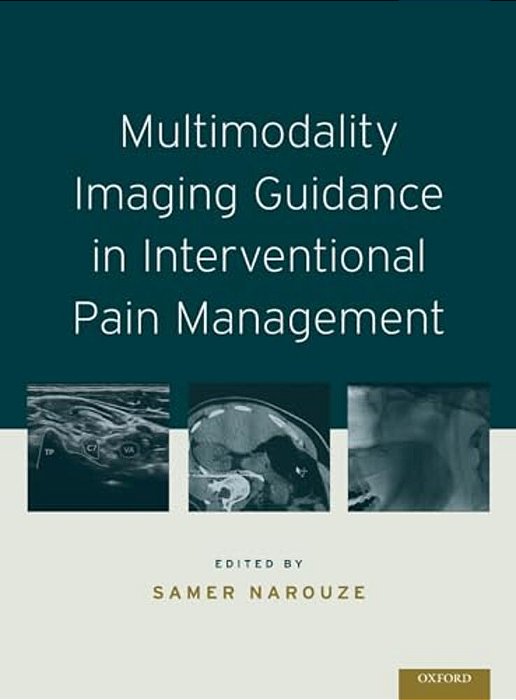 Multimodality Imaging Guidance In Interventional Pain Management-..