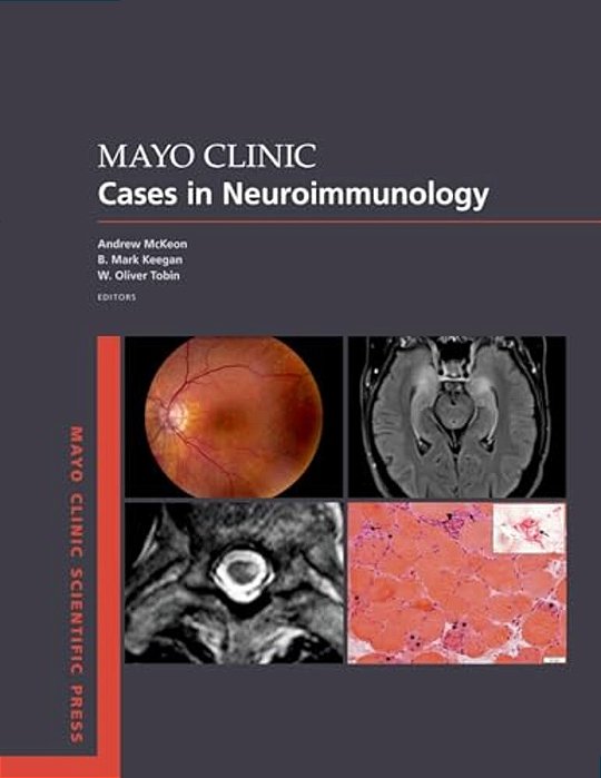 Mayo Clinic Cases In Neuroimmunology-..