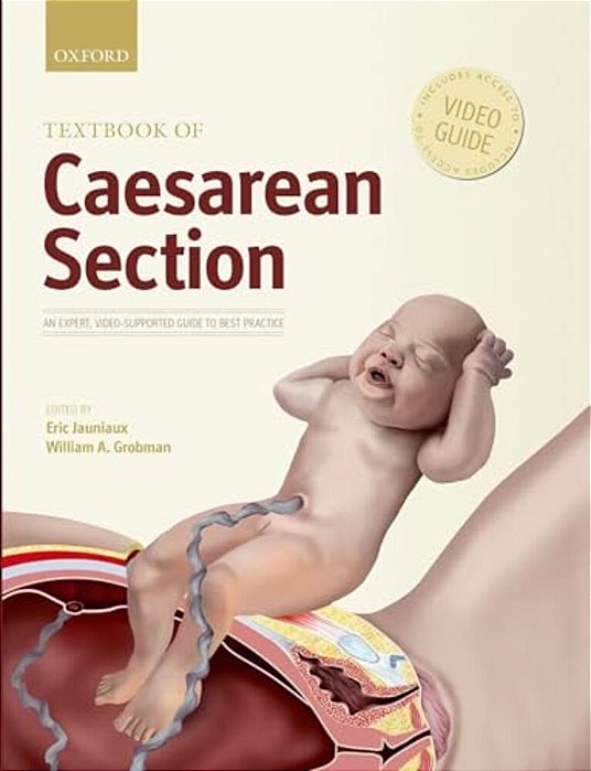 Textbook Of Caesarean Section-..