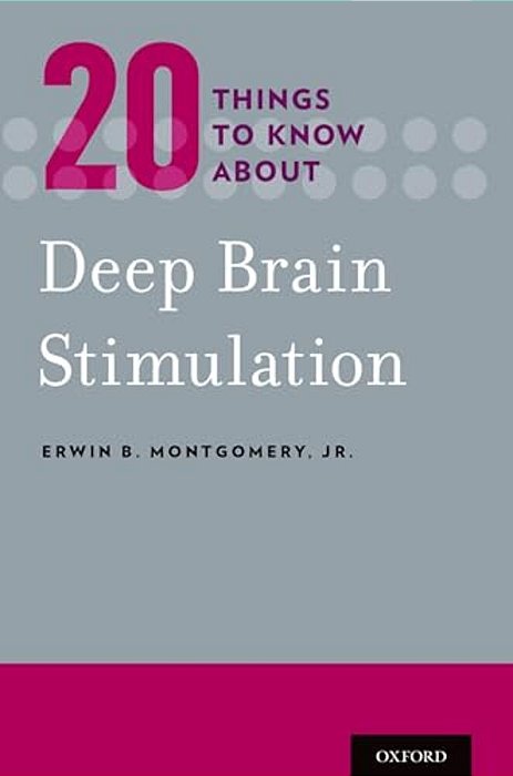 20 Things To Know About Deep Brain Stimulation-..