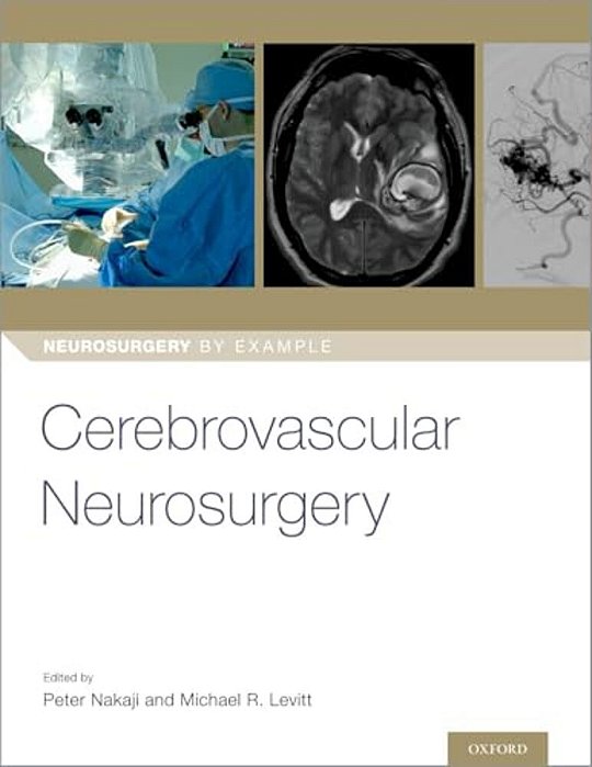 Cerebrovascular Neurosurgery-..