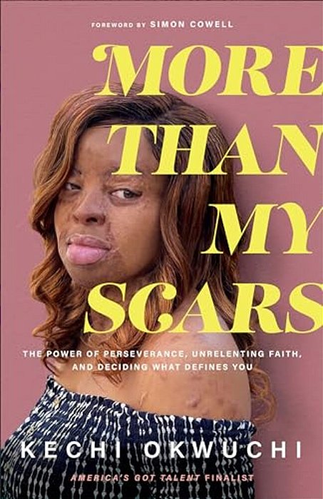 More Than My Scars-..