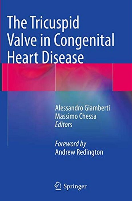 The Tricuspid Valve In Congenital Heart Disease-..