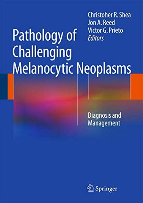 Pathology Of Challenging Melanocytic Neoplasms: Diagnosis And Management-..