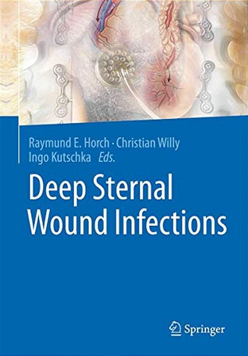 Deep Sternal Wound Infections-..
