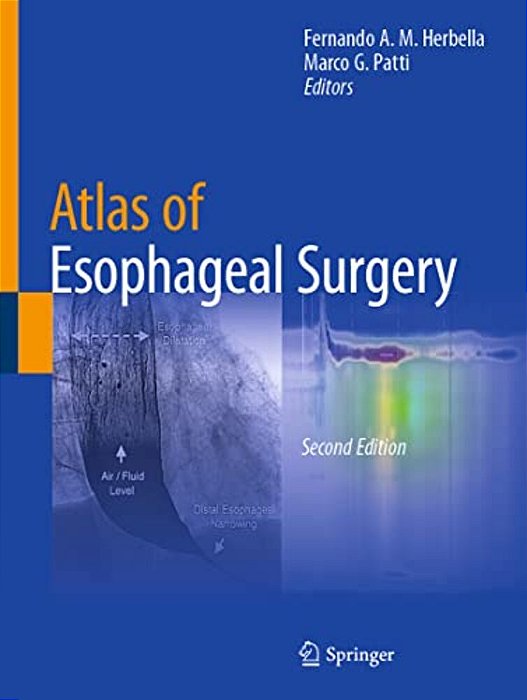 Atlas Of Esophageal Surgery-..