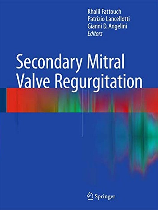 Secondary Mitral Valve Regurgitation-..