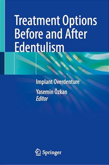 Treatment Options Before And After Edentulism: Implant Overdenture-..