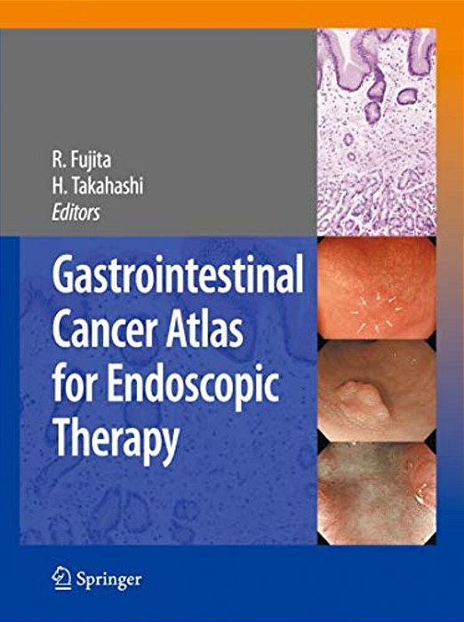 Gastrointestinal Cancer Atlas For Endoscopic Therapy-..