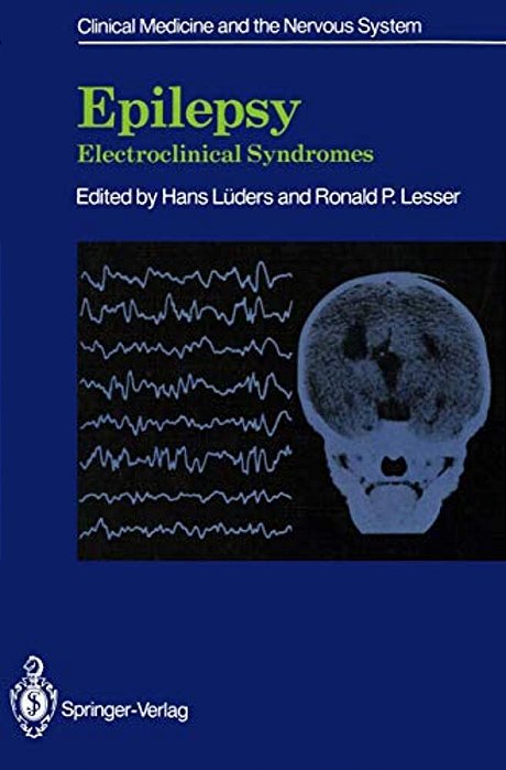 Epilepsy: Electroclinical Syndromes-..