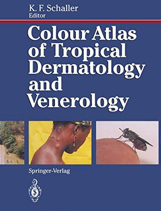 Colour Atlas Of Tropical Dermatology And Venerology-..