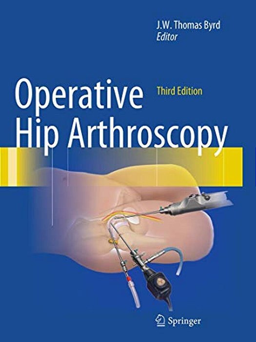 Operative Hip Arthroscopy-..
