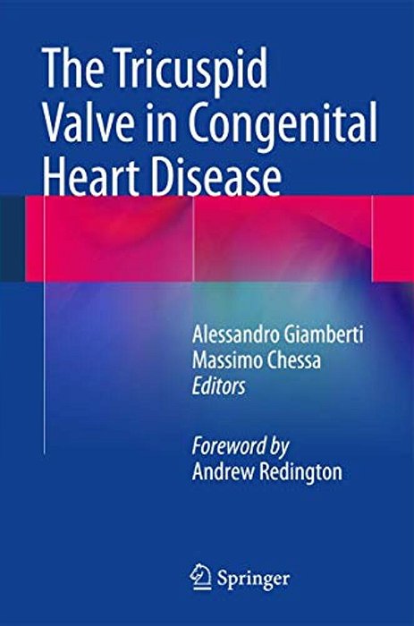 The Tricuspid Valve In Congenital Heart Disease-..