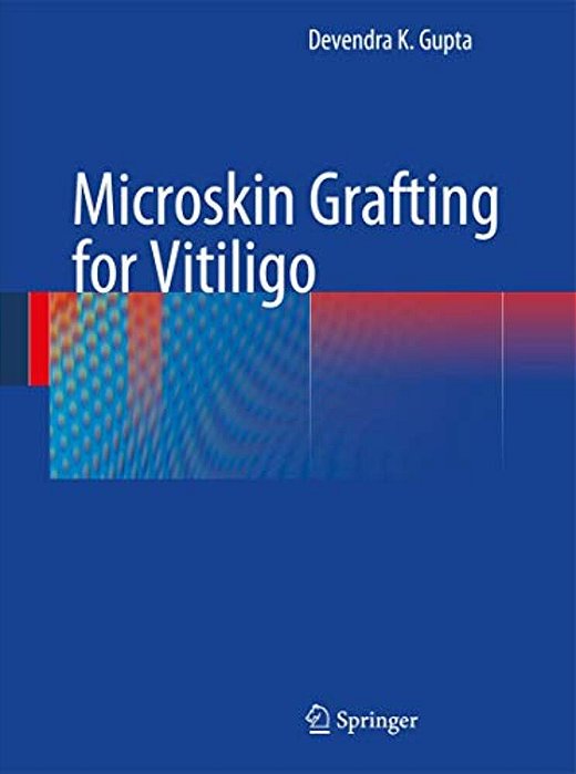 Microskin Grafting For Vitiligo-..